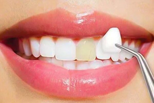 Cosmetic Dentistry