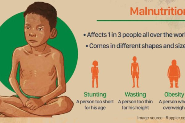 What Is Malnutrition