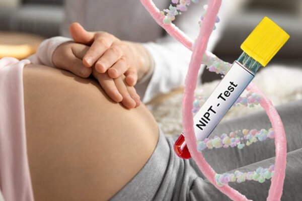 NIPT Blood Test